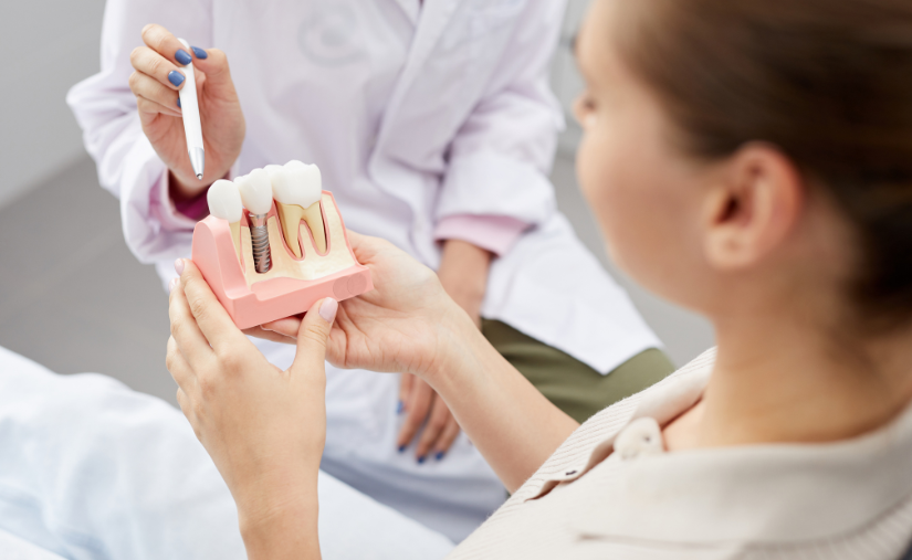 Recommendations After Dental Implants